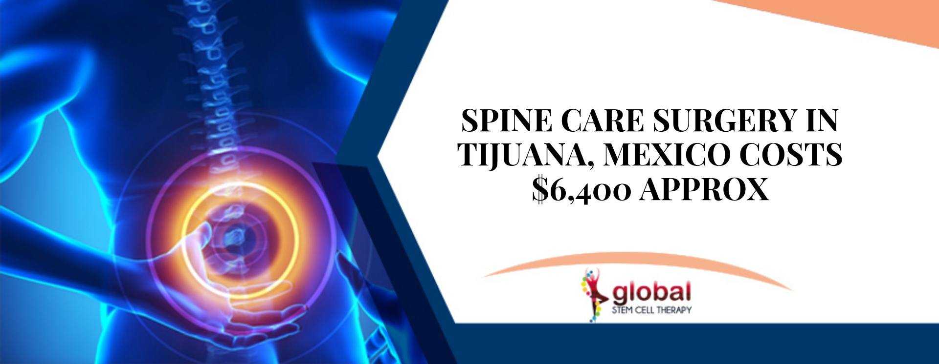 Spine Care_Surgery in Tijuana, Mexico